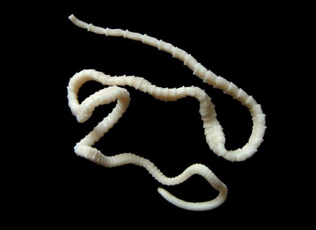 bovine tapeworm in the human body