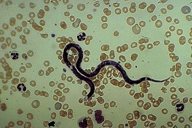subcutaneous parasitic filaria