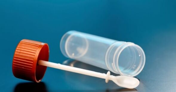 Parasitic tests